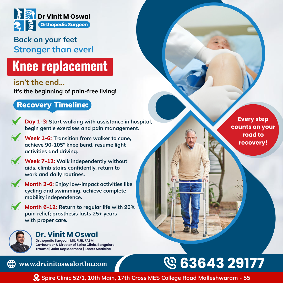 Knee Replacement in Bangalore